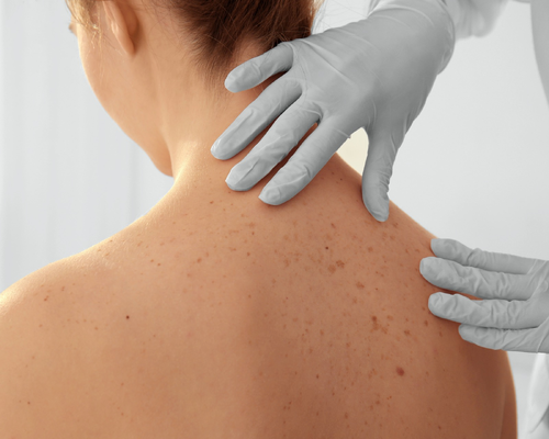 Forum: Dermatologija